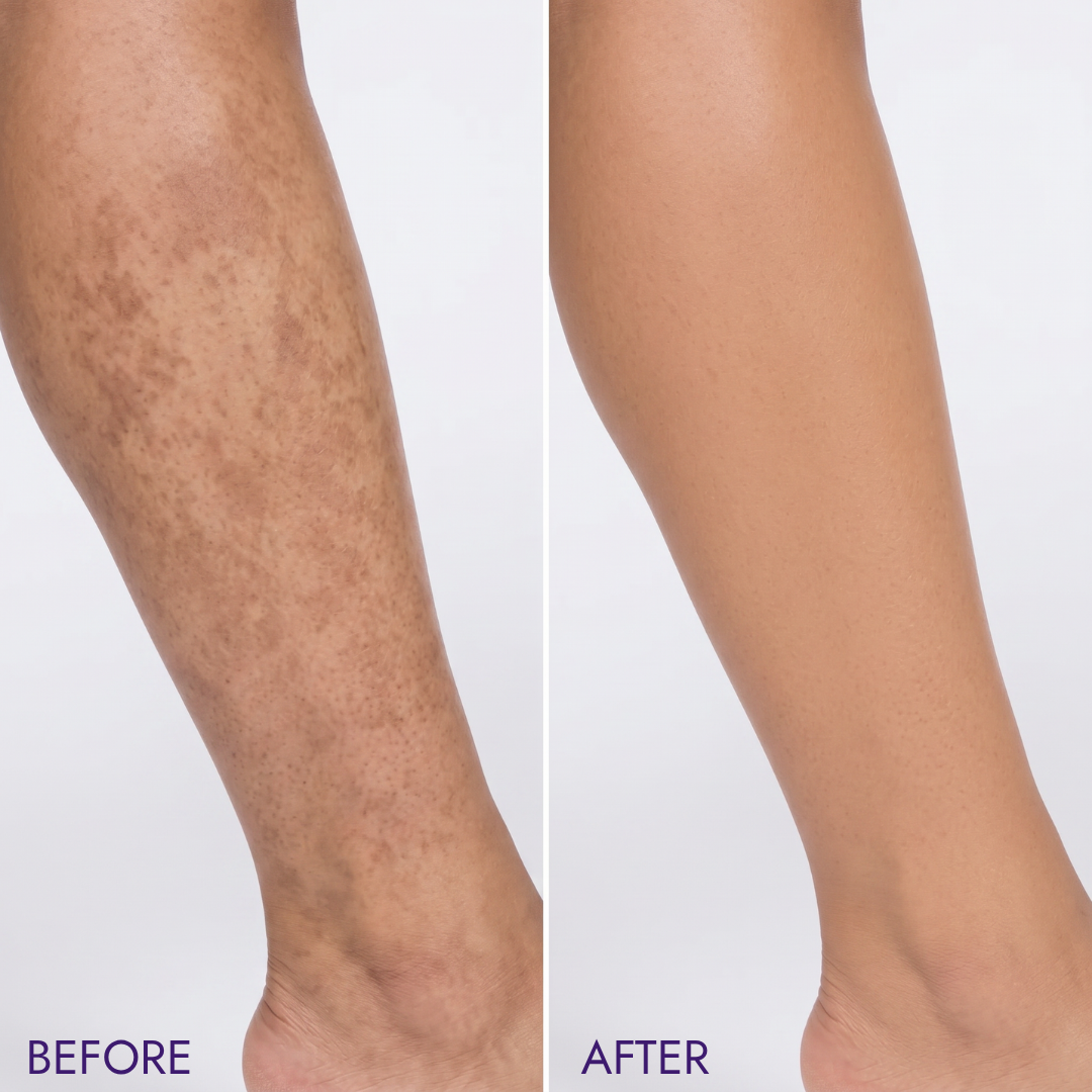 NOOLA Body Perfector