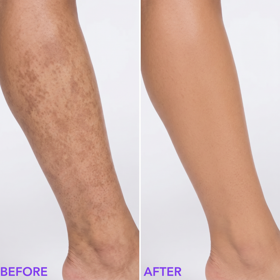 NOOLA Body Perfector