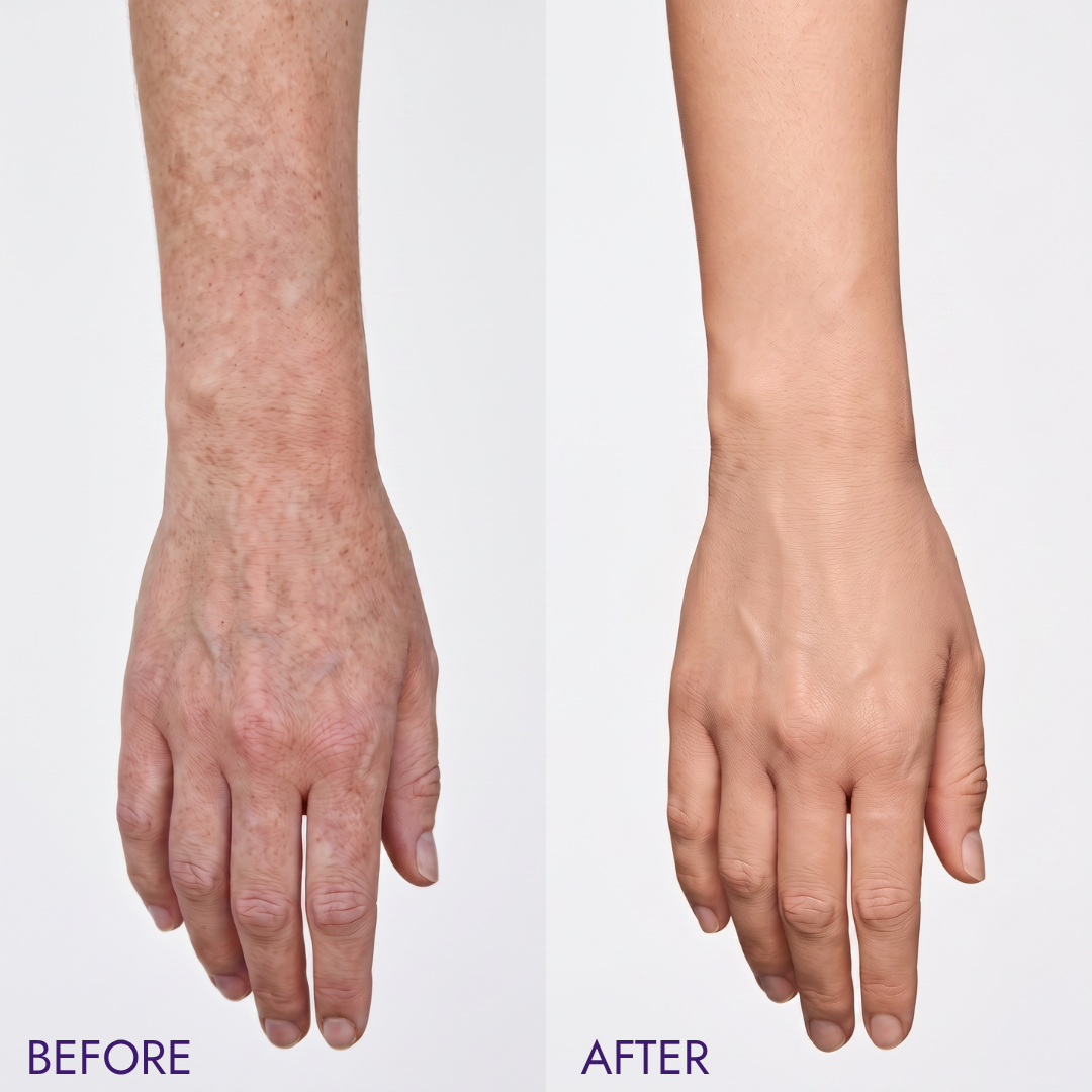 NOOLA Body Perfector